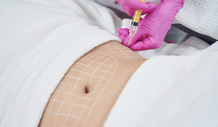 Read more about the article Tighten and contour your Body shape